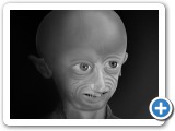 Progeria2